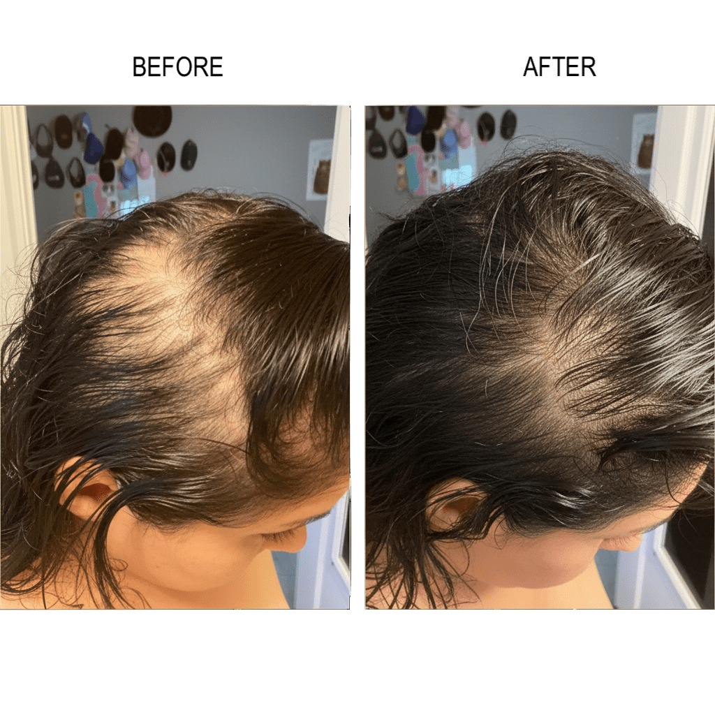 REGENERATE® NATURAL HAIR GROWTH SERUM - Regenerate